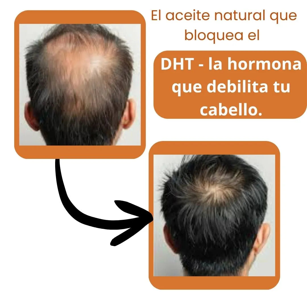 Pumpkin Seed Oil -Aceite de Semillas de Calabaza